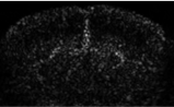 Real Open-Skull Image