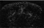 Synthetic Transcranial Image